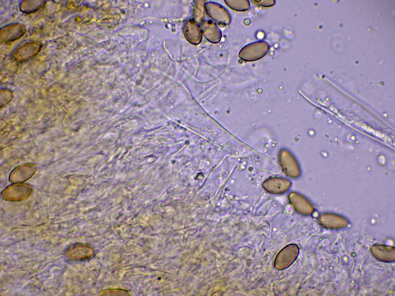Agrocybe arvalis 10 - Pileocistidio-003